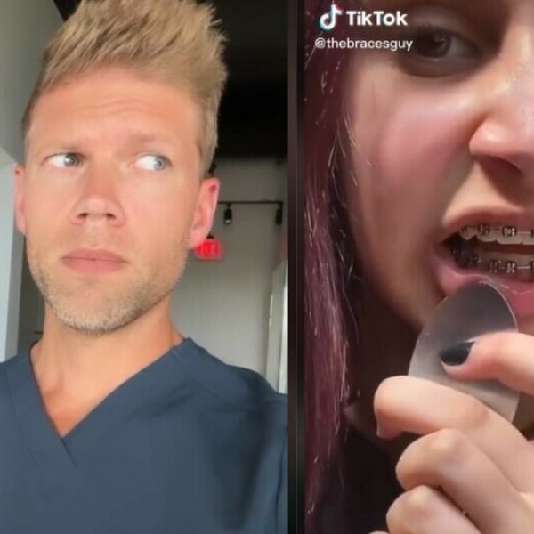 На ТикТок кружи опасен тренд: Луѓето почнуваат сами ги вадат протезите од заби, сега стоматолог откри зошто тоа е опасно (ВИДЕО)