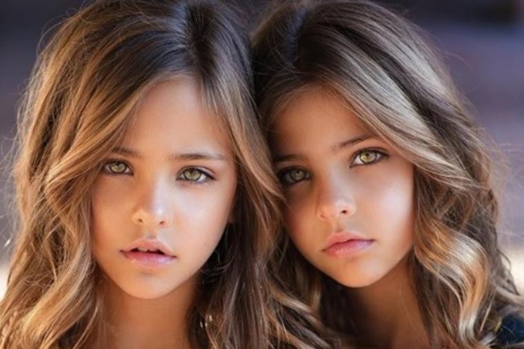 Што се крие зад оваа фотка: Каква е судбината на најубавите близначки во светот?