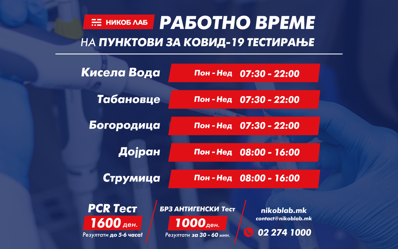 Промена на работното време на пунктовите за Covid-19 тестирање на НИКОБ ЛАБ