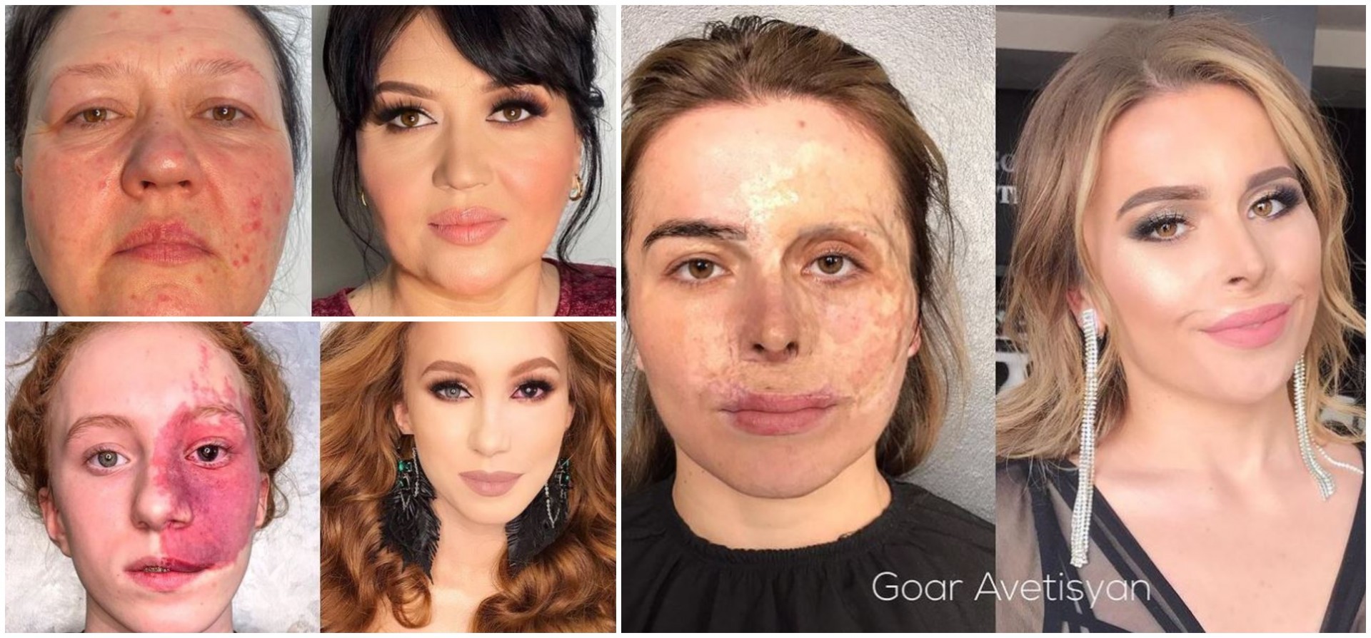 Руска шминкерка разубавува девојки со лузни и акни: Им ја враќа самодовербата, а трансформациите се неверојатни