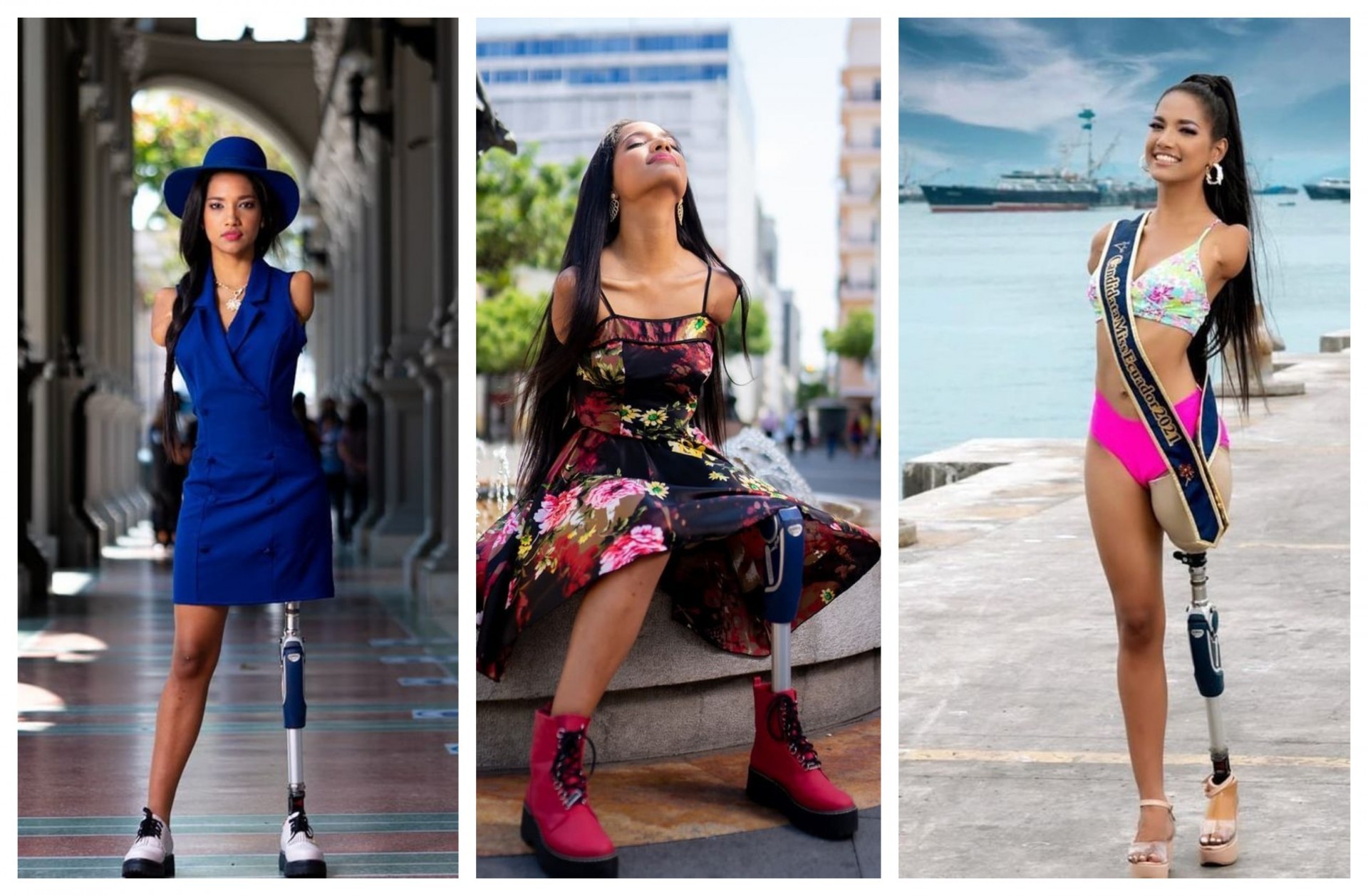 Викторија на пет години ги загуби двете раце и една нога: Денес е манекенка со инвалидитет која ги урива предрасудите