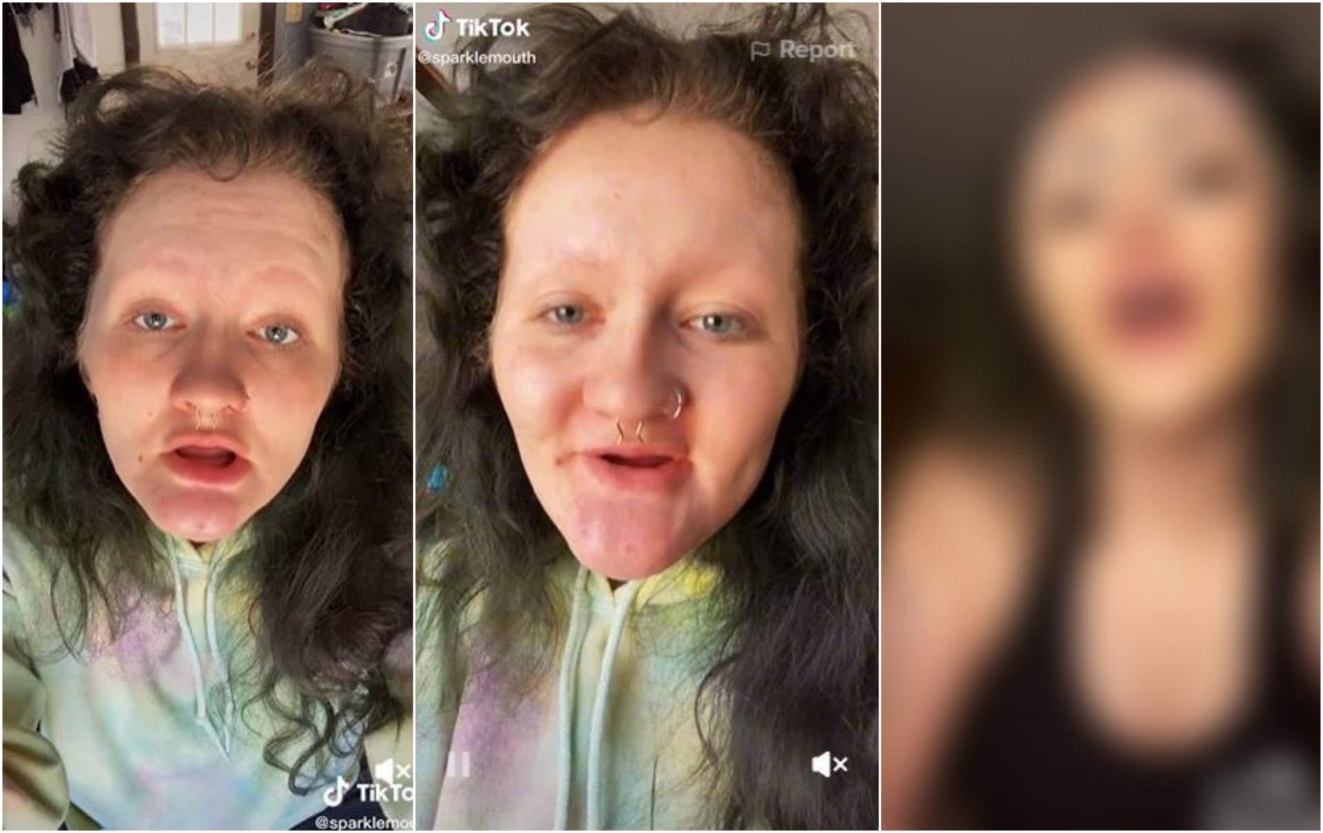 Девојка без заби и веѓи покажа колку е моќна шминката: Луѓето на социјалните мрежи се воодушевени