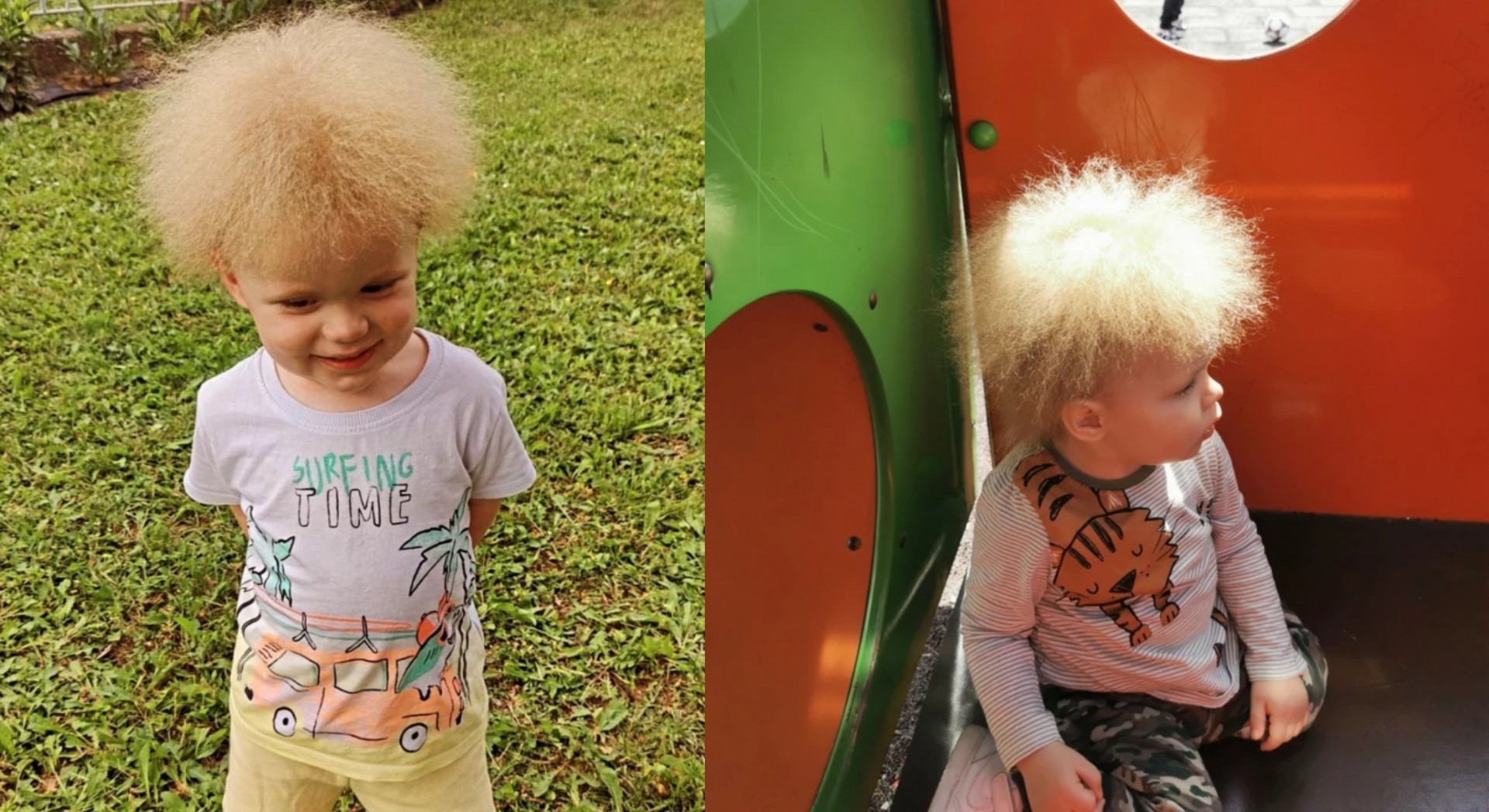 Лав е едно од 100-те деца во светот со ваква коса: Има синдром на „палава коса“ и ги импресионира сите со слаткиот изглед