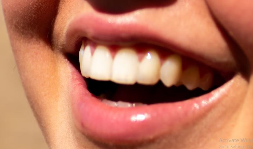 Ви мириса устата и по миењето на забите? Лошиот здив се појавува поради овие 6 причини