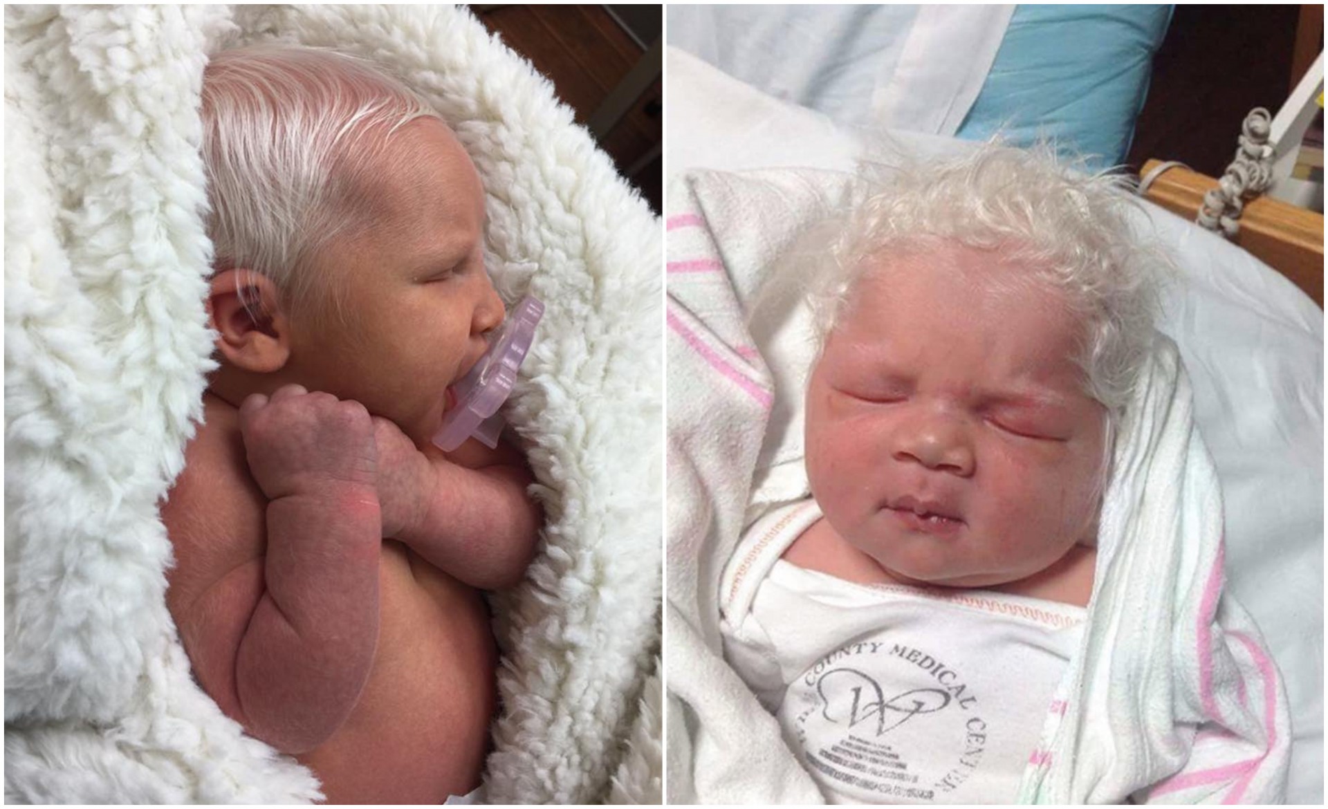 Бебе се родило со потполно седа коса: Докторите не знаат како да го објаснат овој феномен, а неговите фотографии го заобиколија светот (ВИДЕО)