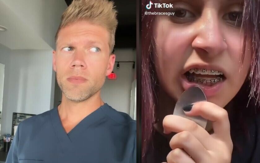 На ТикТок кружи опасен тренд: Луѓето почнуваат сами ги вадат протезите од заби, сега стоматолог откри зошто тоа е опасно (ВИДЕО)