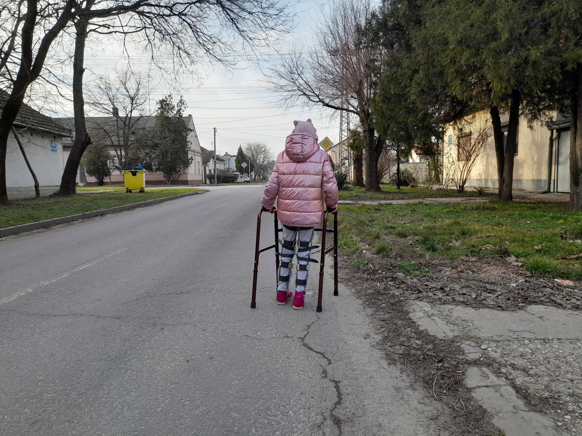 Татко објави фотографија од ќерката која со помагало за одење оди да му купи цигари: Пред да судите, прочитајте ја приказната