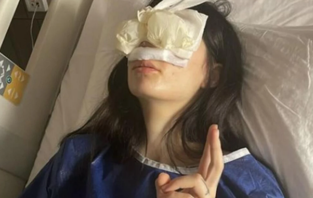Српската инфлуенсерка плати 7.000 евра за операција на носот, а на 20 години стави и силикони: „Не можев сама да станам од кревет“