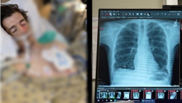 Чудо: Му требаше двојна трансплантација на бели дробови, но лекарите беа водени од Божјата рака