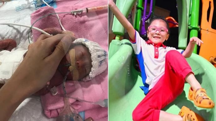 Беше е родена како најмалото предвремено родено бебе во земјата: Денес е здраво и успешно петгодишно дете