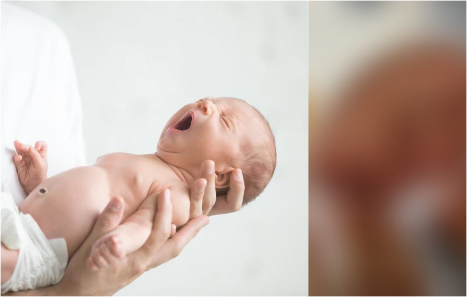 Бебе родено со опашка од 10 сантиметри која расте од грбот: Видеото се појави на интернет, еве што велат лекарите