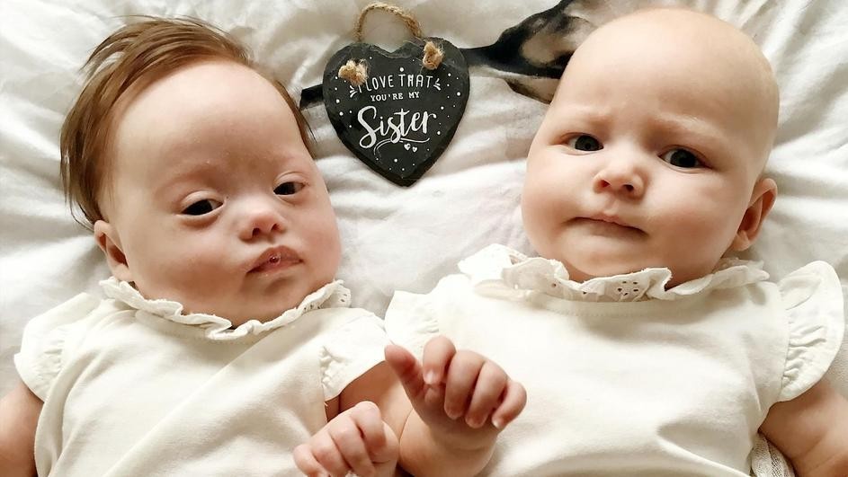 Едни се во милион: Приказната за близначките Харпер и Квин
