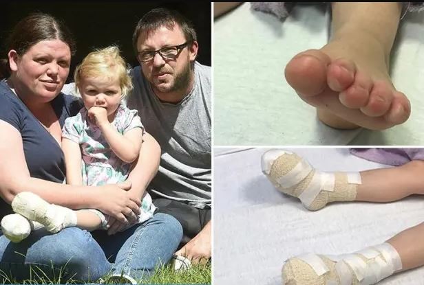 Тригодишно девојче си ги изгоре стапалата на плажа, заврши во завои: Семејството упати апел