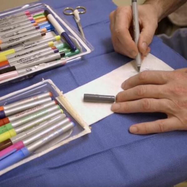 Причината е неверојатна: Детски хирург по секоја операција скалперот го заменува со фломастери