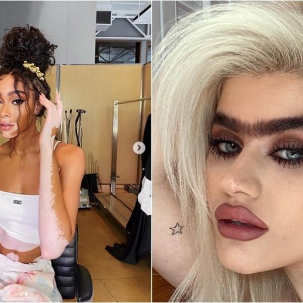 Не изгледаат како Џиџи и Кендал, но се топ модели: 10 девојки кои го уништија традиционалниот поим за убавина