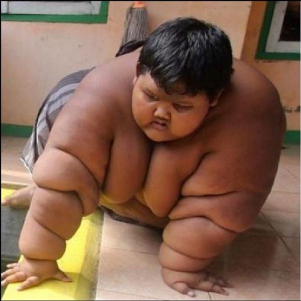 Најдебелото дете на светот на диета: Ослабна 110 килограми, погледнете како изгледа сега