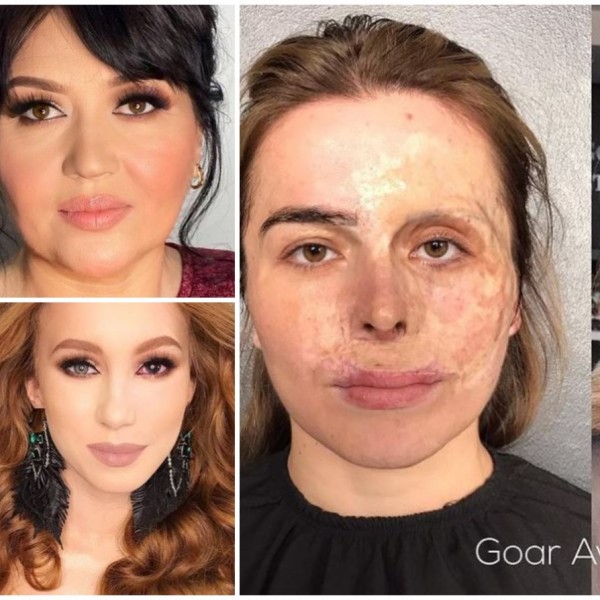 Руска шминкерка разубавува девојки со лузни и акни: Им ја враќа самодовербата, а трансформациите се неверојатни