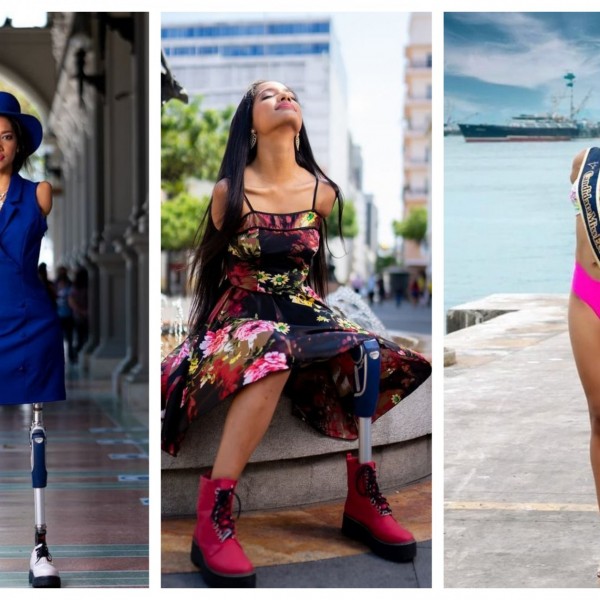 Викторија на пет години ги загуби двете раце и една нога: Денес е манекенка со инвалидитет која ги урива предрасудите