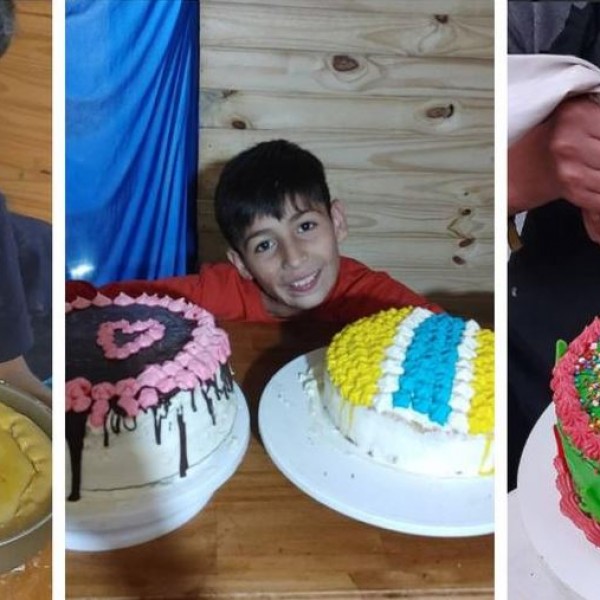 10-годишно момче воодушевува со талентот: Прави неверојатни колачи, а со заработката сака да плати за отстранување на лузната