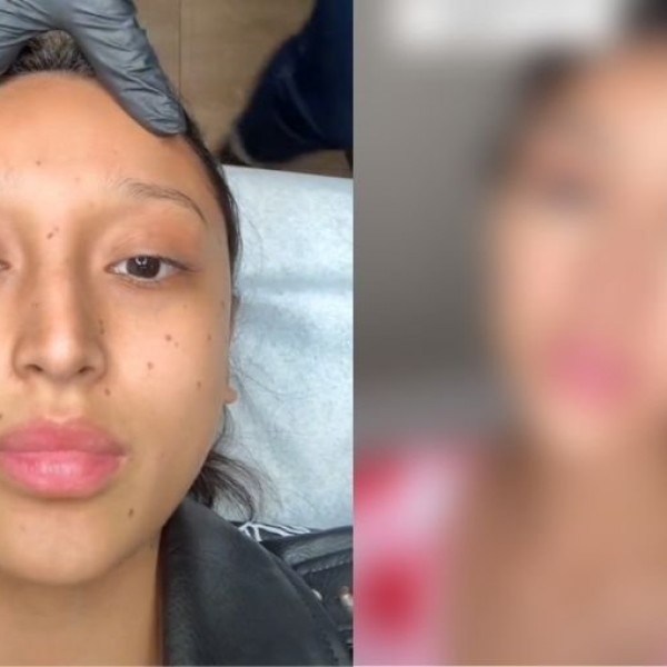 Пегите се во тренд повеќе од кога било: Една девојка заминала да го истетовира лицето - сега сите ѝ се смеат