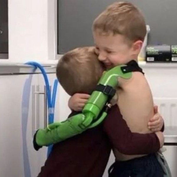 На среќата нема крај: Момче родено без рака, сега конечно може да го прегрне својот брат