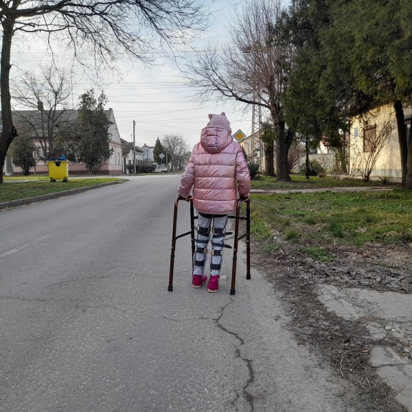 Татко објави фотографија од ќерката која со помагало за одење оди да му купи цигари: Пред да судите, прочитајте ја приказната