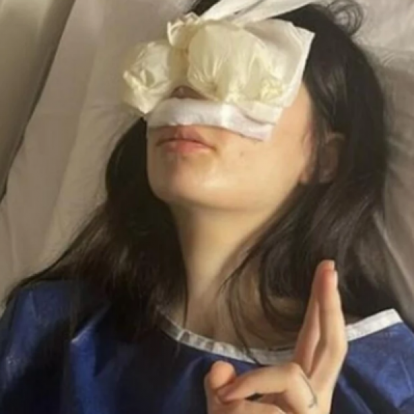 Српската инфлуенсерка плати 7.000 евра за операција на носот, а на 20 години стави и силикони: „Не можев сама да станам од кревет“