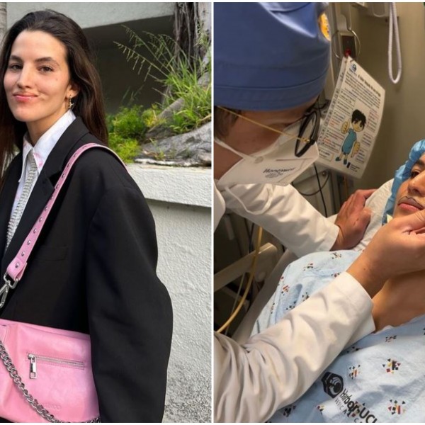 Манекенка (23) доживеала пекол по напад од пит бул: Веќе преживеала 7 операции, а еден дел од лицето ѝ е трајно оштетен