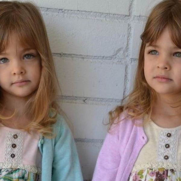 Најубавите близначки во светот, денес изгледаат вака: Мајка им обвинета дека им правела притисок за да заработуваат пари на нив (ФОТО)