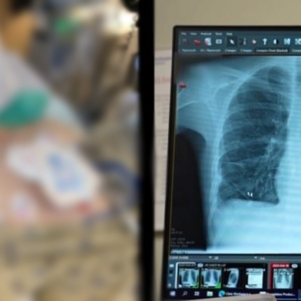 Чудо: Му требаше двојна трансплантација на бели дробови, но лекарите беа водени од Божјата рака