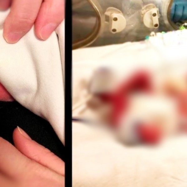 Се роди во 24-та недела, неговото стапало беше помало од прстот на мајка му: Но, погледнете како изгледа денес (ФОТО)