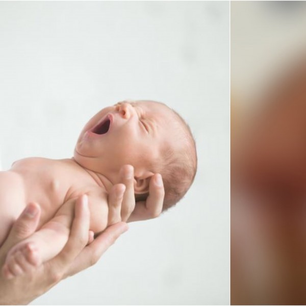 Бебе родено со опашка од 10 сантиметри која расте од грбот: Видеото се појави на интернет, еве што велат лекарите