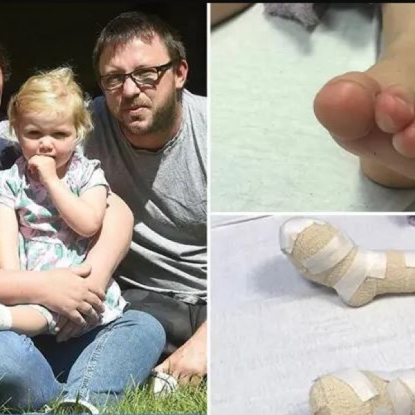 Тригодишно девојче си ги изгоре стапалата на плажа, заврши во завои: Семејството упати апел